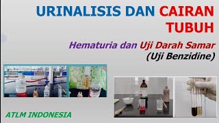 Hematuria dan Uji Darah Samar Benzidine Test  Urinalisis  Carik Celup Blood [upl. by Sellig671]