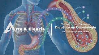 ►Manejo del Paciente Diabético en Odontología  DrJosé Luis Becerra Beltrán [upl. by Huskey]