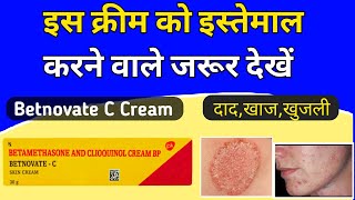 Betnovate c skin cream review  Betnovate c lagane se kya hota hai [upl. by Attenohs]