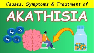 Akathisia by Antipsychotics  Causes Symptoms and Treatments [upl. by Concha163]