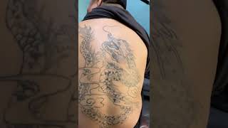 Picosecond laser treatment for tattoo removal [upl. by Enowtna254]