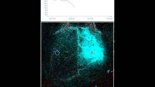 Needle induced Cortical Spreading Depression  Difference Image mode [upl. by Herbst868]