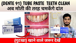 तीन दिन में दांत चमकेंगे मोती की तरह ॥ Dente91 AntiStain Expert Toothpaste  Teeth Cleaning Paste [upl. by Libove458]