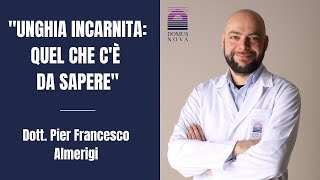 Unghia incarnita quel che c’è da sapere  Dottor Pier Francesco Almerigi [upl. by Alegnatal]