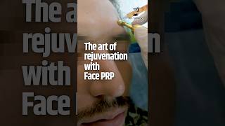 Skin Rejuvenation Treatment  PRP Treatment for Face Benefits  How to get rid of Wrinkles on Face [upl. by Deegan785]