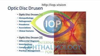 Optic Disc Drusen Part 1 Preview [upl. by Eva]