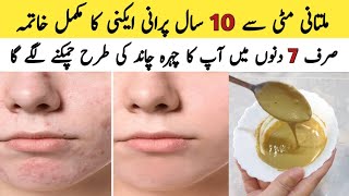 Multani Mitti Face Pack For Every Skin Type How to Remove Acne And Pigmentation [upl. by Bilbe]