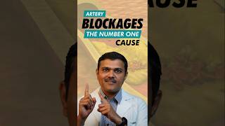 The 1 Cause of Blocked Arteries in 2024 You Need to Know [upl. by Notle]