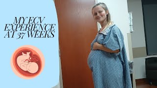 My ECV experience at 37 weeks pregnant  THE CC FARM [upl. by Nsaj]