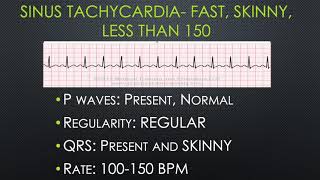 Breaking Down BASIC Dysrhythmias [upl. by Redla]