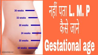 How to calculate  know Gestational age [upl. by Ferino]