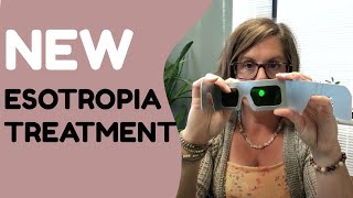 New Treatment For Esotropia [upl. by Marelda]