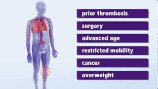 About Thrombosis Symptoms and risk factors for deep vein thrombosis DVT [upl. by Annatnom289]