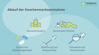 Knochenmarksbiopsie beim MantelzellLymphom  Untersuchung des Knochenmarks Experte erklärt [upl. by Yesnik]