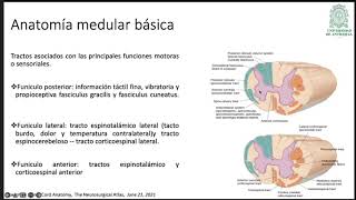 AStrocitoma medular en pediatrìa [upl. by Masao]