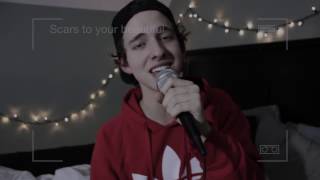 SCARS TO YOUR BEAUTIFUL  ALESSIA CARA COVER [upl. by Carmelo475]