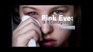 how to get rid of pink eye  conjunctivitis treatment  how to get rid of pink eye fast [upl. by Petey]