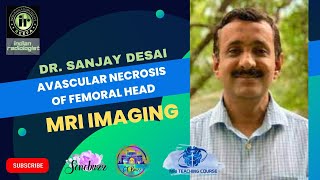 AVASCULAR NECROSIS OF FEMORAL HEAD  DR SANJAY DESAI  mriteachingcourse [upl. by Eblehs172]