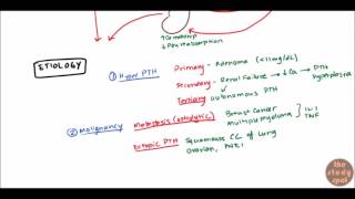 Hypercalcemia for USMLE Step 1 and USMLE Step 2 [upl. by Nahtnoj]