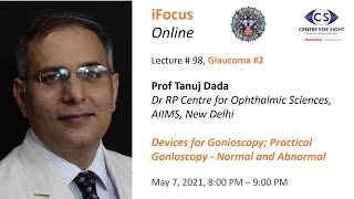 iFocus Online Session 98 Glaucoma 2 Gonioscopy [upl. by Ree]