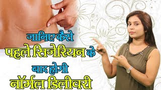 जानिए कैसे पहले सिजेरियन के बाद भी हो सकती है नार्मल डिलीवरी Facts About Cesarean Delivery Health [upl. by Lenee424]