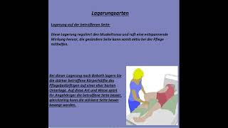 Bobath Konzept Gruppenarbeit [upl. by Ervin]