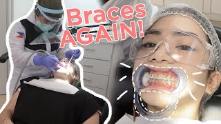 I GOT BRACES AGAIN 😩 Philippines  Jewel Mesina [upl. by Nodnol]