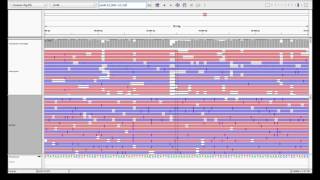 nanopore vs pacbio [upl. by Leinahtam312]