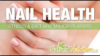 Natural Health Reviews  What Nails Say About Your Health Nail Health Signs  National Nutrition [upl. by Reisman]