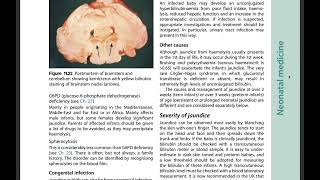 MRCPCH FOPTAS  READ ALONG CHAPTER 11NEONATAL MEDICINEPT2 ILLUSTRATED TEXTBOOK OF PEDIATRICS [upl. by Wing234]