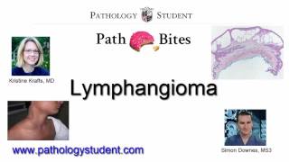 Path Bites  Lymphangiomas [upl. by Rimma]