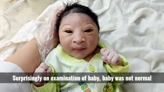 Most beautiful special newborn baby after birth with small Head and black eyes usa [upl. by Akenna463]