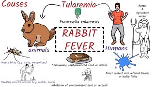 Tularemia Rabbit Fever Symptoms Pathogenesis Diagnosis Treament [upl. by Lehcyar139]