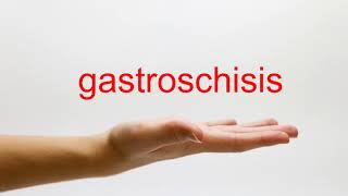 How to Pronounce gastroschisis  American English [upl. by Cordey218]