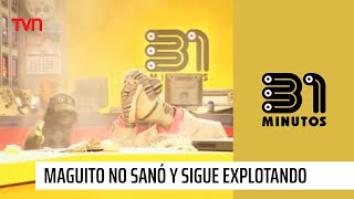 Maguito no sanó y sigue explotando se volverá a internar  31 Minutos [upl. by Dnarud586]