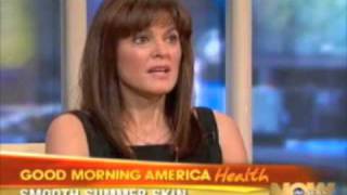 Laser Hair Removal in Houston with Lightsheer Duet on Good Morning America  Ovation Med Spa [upl. by Emile]