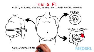 Abdominal Distension The 6 Fs that can help your diagnosis [upl. by Ahsar]