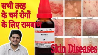 Sulphur Mother Tincture ko kaun kaun si skin disease चर्म रोग में use Karen aur kaise use Karen [upl. by Airrehs]