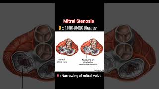 Heart sounds🫀 Heartsounds doctor heart sounds medicalstudy neet medicalstudent chestpain 🫀 [upl. by Durrett]