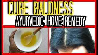 LOSING HAIR quick home remedy  ANCIENT INDIAN SECRETS [upl. by Blessington]