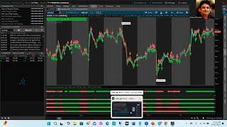 How to make consistent Gains with Options Trading [upl. by Pelligrini342]