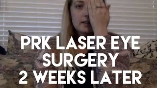 PRK LASER EYE SURGERY 2016  2 WEEKS LATER [upl. by Araminta970]