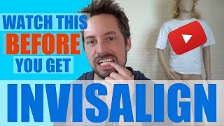 WHAT IS INVISALIGN [upl. by Aehr]