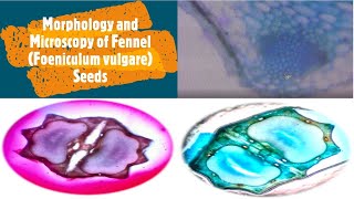 Morphology and Microscopy of Fennel Foeniculum vulgare Miller Seeds [upl. by Bouton991]