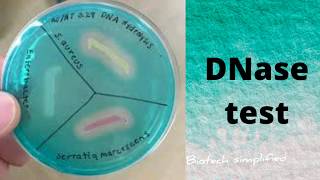 DNA hydrolysis test or Deoxyribonuclease DNase test [upl. by Araiet]