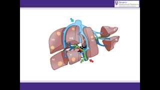 ALPPS procedure animation  A surgical solution for initially unresectable liver tumours [upl. by Ruvolo]