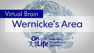 On With Life Virtual Brain  Wernickes Area [upl. by Annahahs]