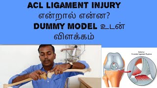 Ligament injury Tamil knee ligament injury Ligament injuryAcl ligament injuryTamil ACL Cut [upl. by Aneerol]