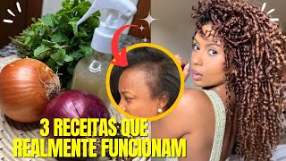 O CABELO CRESCE EXTREMAMENTE RÁPIDO ESSA É A MELHOR MANEIRA RECEITA COM ALECRIM PARA O CRESCIMENTO [upl. by Adnuhsat514]