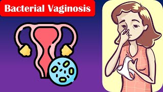 Bacterial Vaginosis  Causes Risk Factors Signs amp Symptoms Diagnosis And Treatment [upl. by Adnesor]